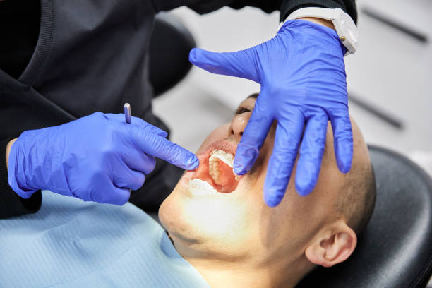 Best Emergency Gum Pain Relief  in Combes, TX